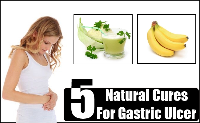 5 Natural Cures For Gastric Ulcer  Natural Home Remedies ...