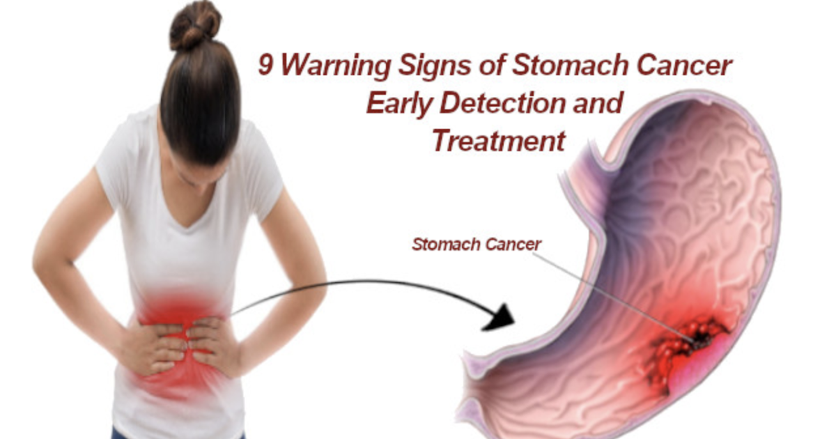 9 Warning Signs of Stomach Cancer Early Detection and ...