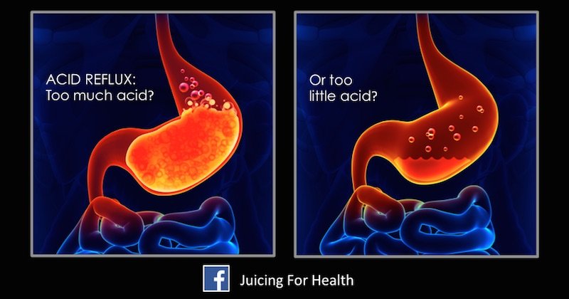 Acid Reflux: How To Test If You Have Low Or High Stomach ...
