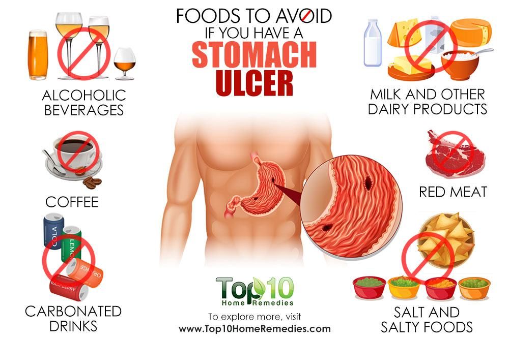 Foods to Avoid if You Have a Stomach Ulcer