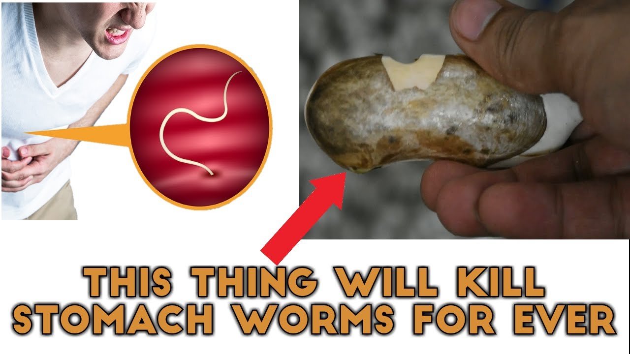 Get Rid of Stomach Worms At Home [Intestinal Worms Home ...