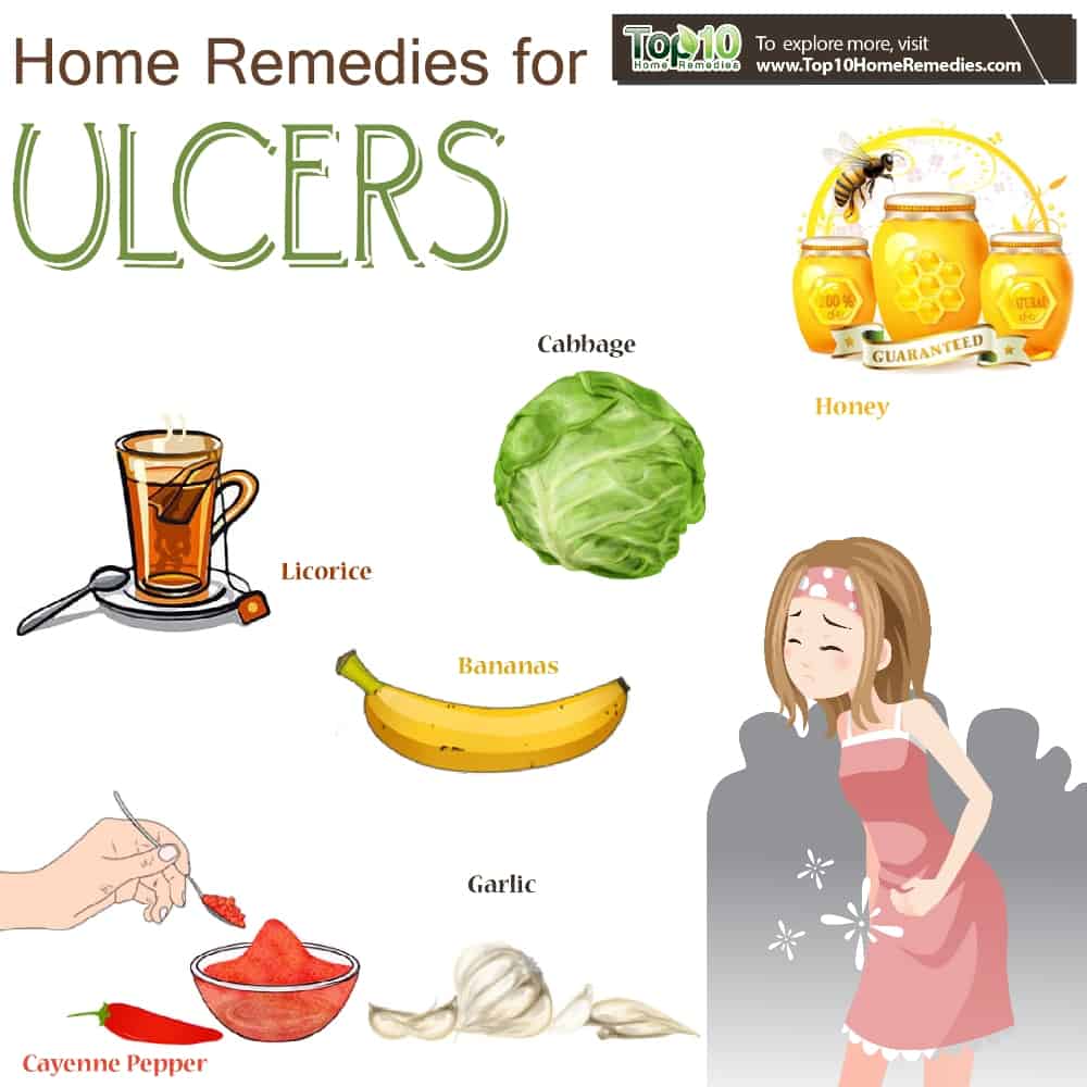 Home Remedies for Ulcers