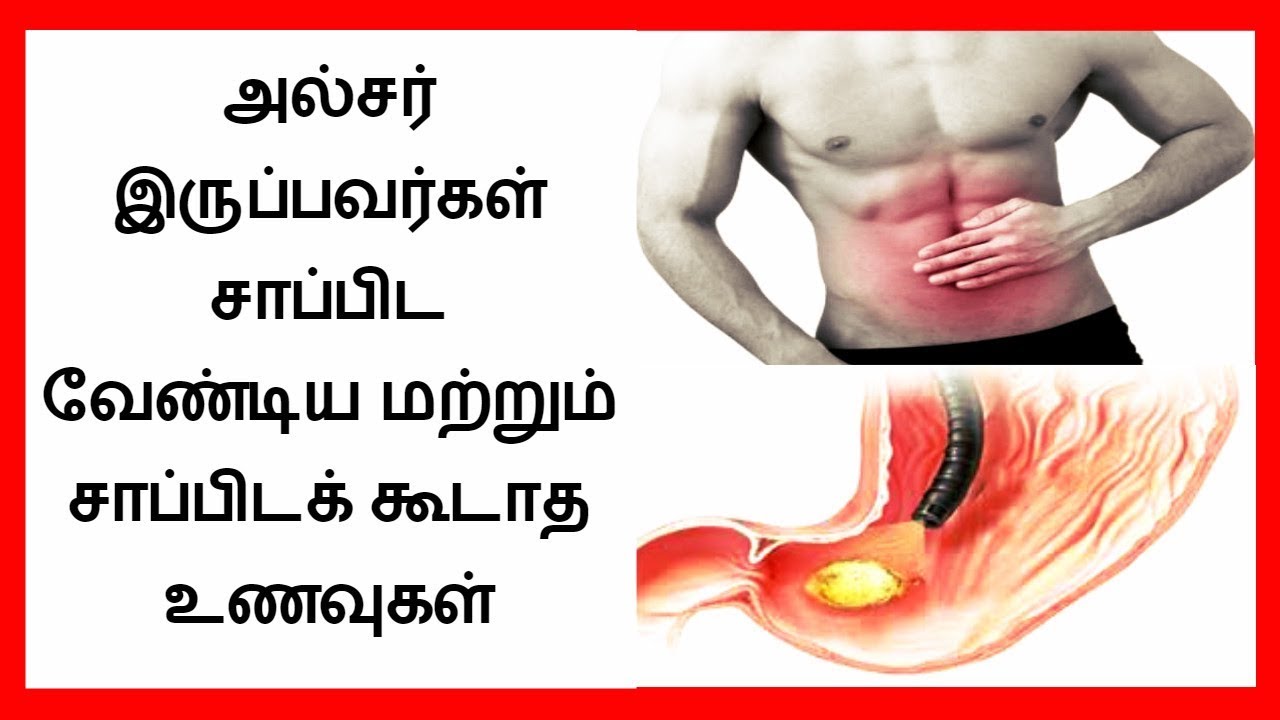 How to cure ulcer in stomach naturally in tamil ...