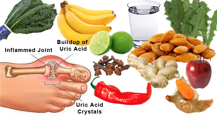 How To Eat Your Way Out Of Uric Acid Build Up And Get Rid ...