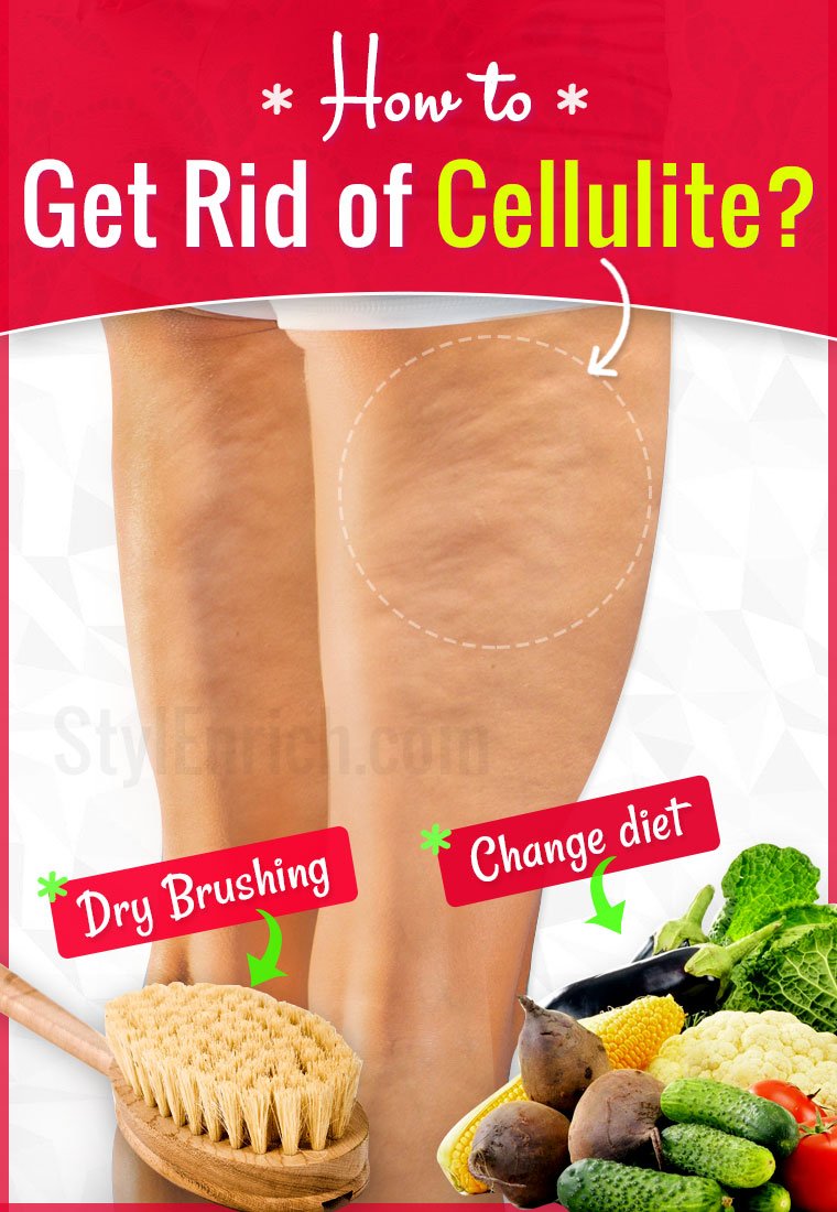 How to Get Rid of Cellulite from Thighs, Buttocks, Hips ...