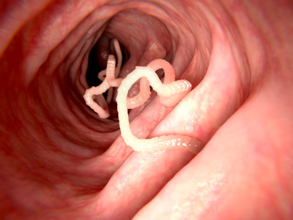 How To Get Rid Of Tapeworms In Humans Naturally â David ...