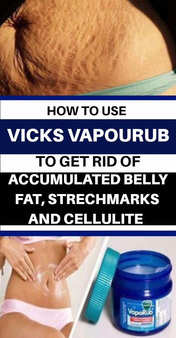 How to Use Vicks VapoRub to Get Rid of Accumulated Belly ...