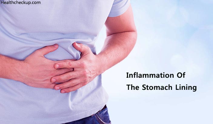 Inflammation of Stomach Lining (Gastritis) Symptoms ...