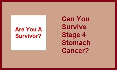 Stage 4 Stomach Cancer Life Expectancy