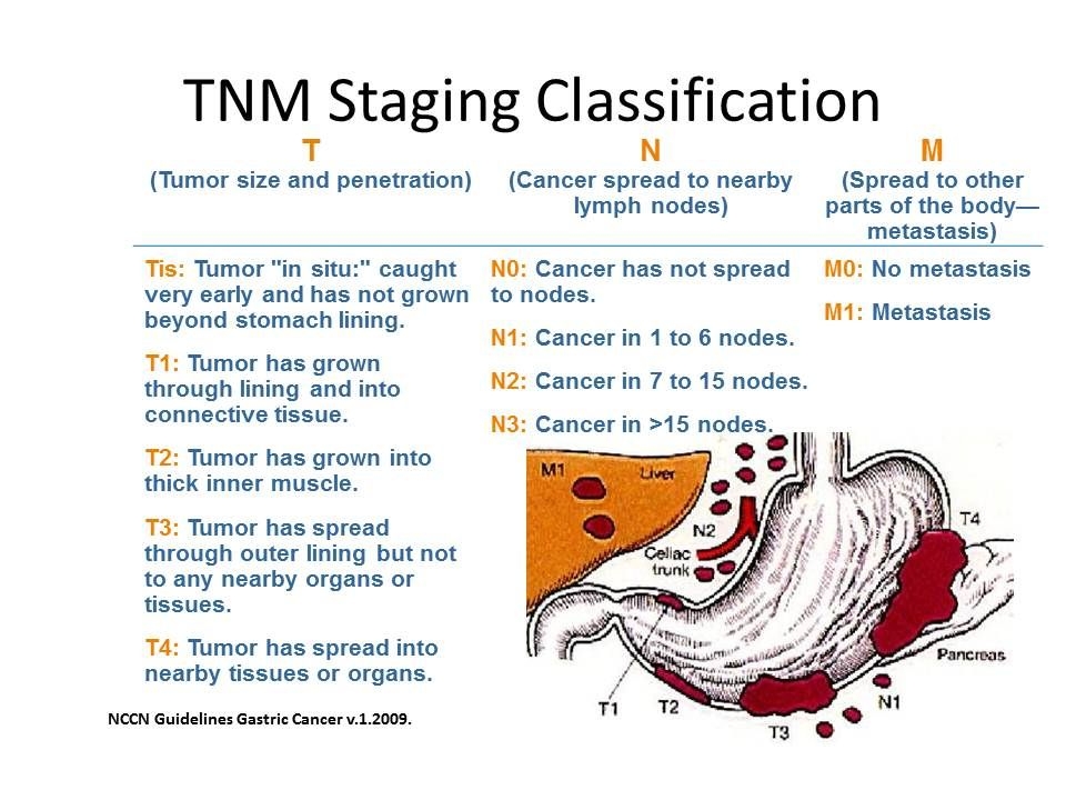 Stage Iii Stomach Cancer