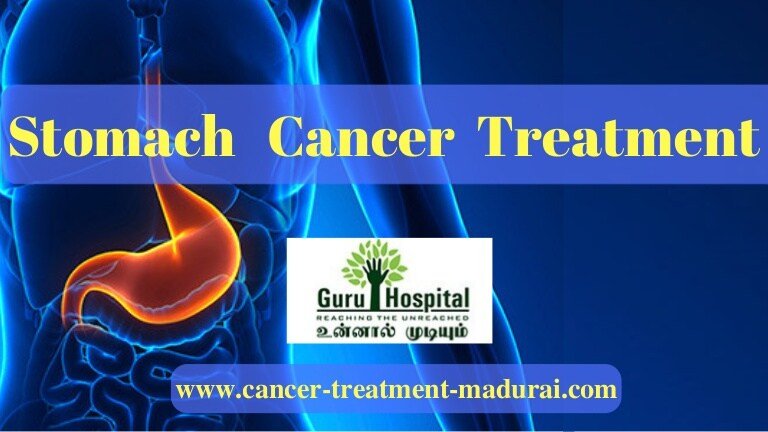 Stomach Cancer Treatment In Madurai