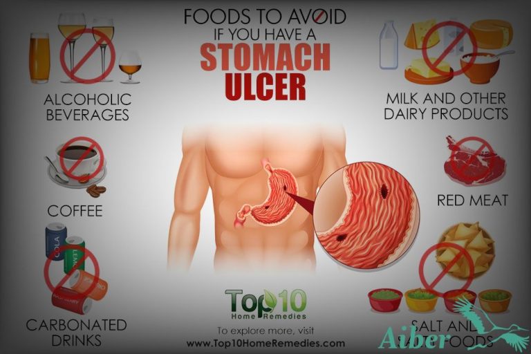 Stomach Ulcers and What You Can Do About It ã?GuÃa ...