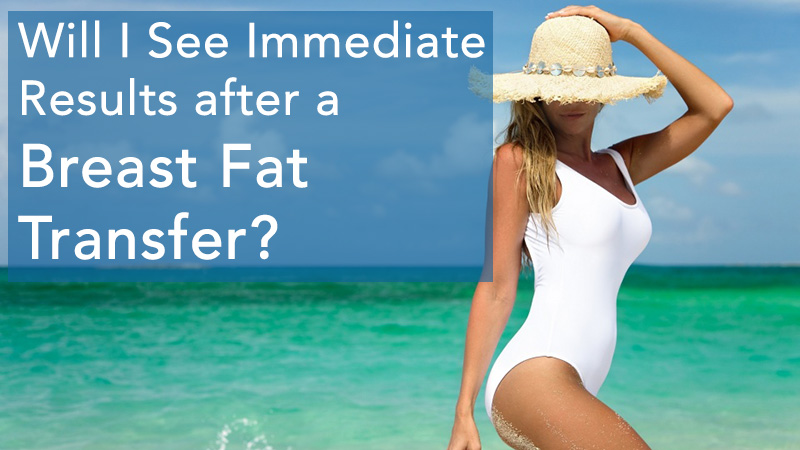 Will I See Immediate Results after a Breast Fat Transfer ...
