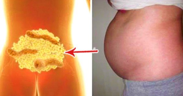 You Are Not Fat! Your Stomach Is Just Bloated! Here Are ...