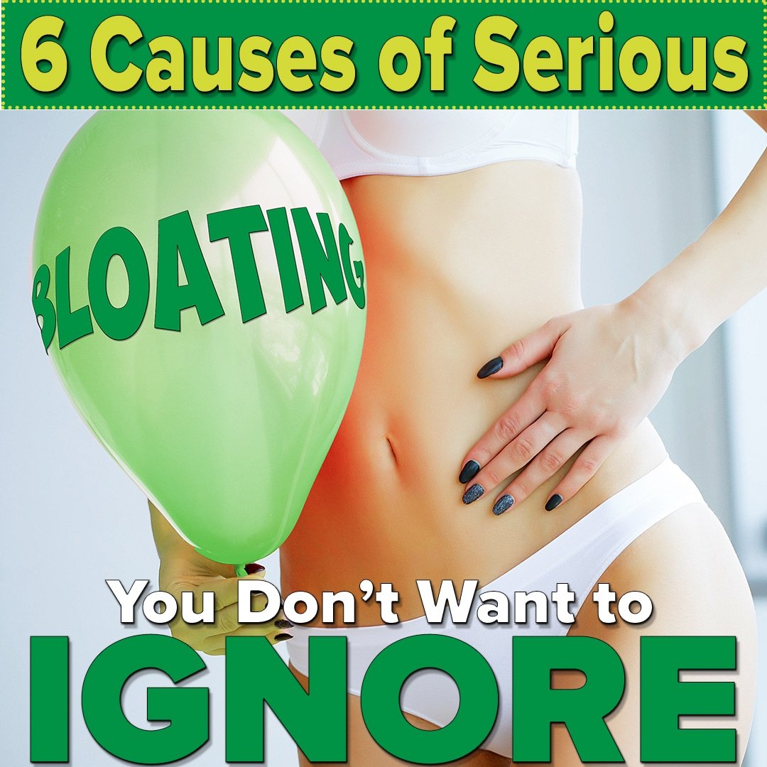 6 Causes of Serious Bloating You Donât Want to Ignore ...