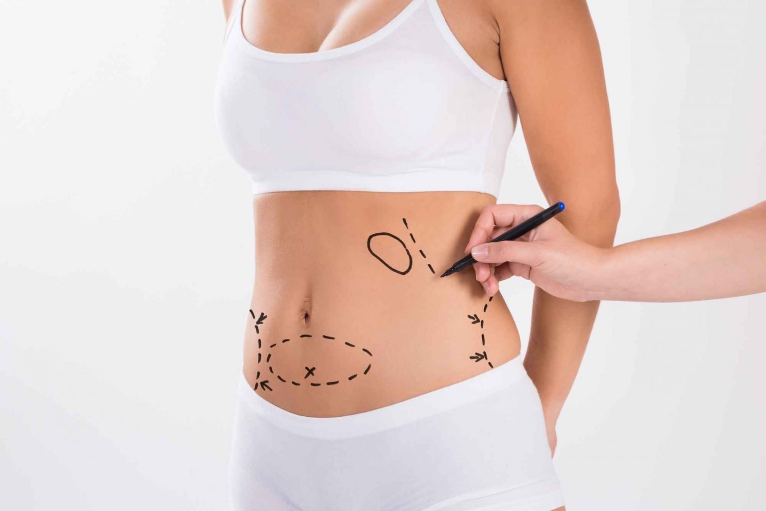 How much does liposuction of the abdomen cost?