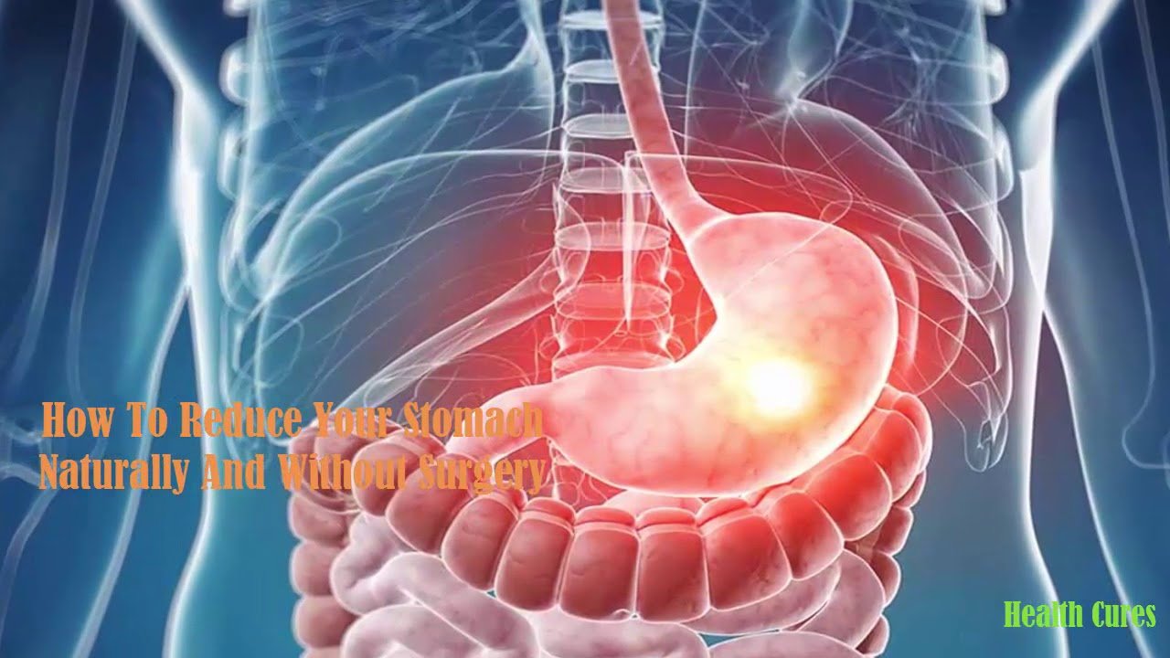 How To Reduce Your Stomach Naturally And Without Surgery ...