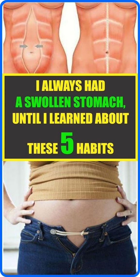 I ALWAYS HAD A SWOLLEN STOMACH, UNTIL I LEARNED ABOUT ...
