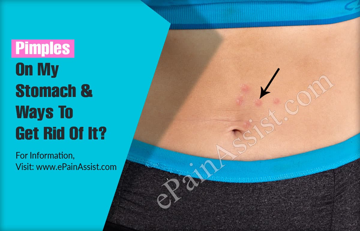 Pimples On My Stomach &  Ways To Get Rid Of It?
