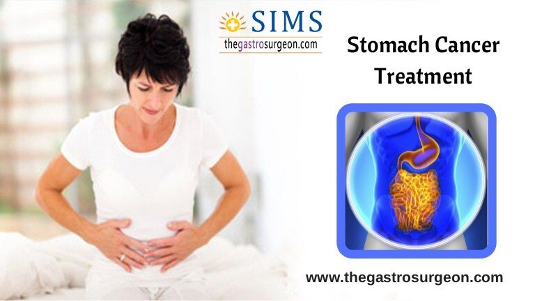 Stomach Cancer Treatment in Chennai