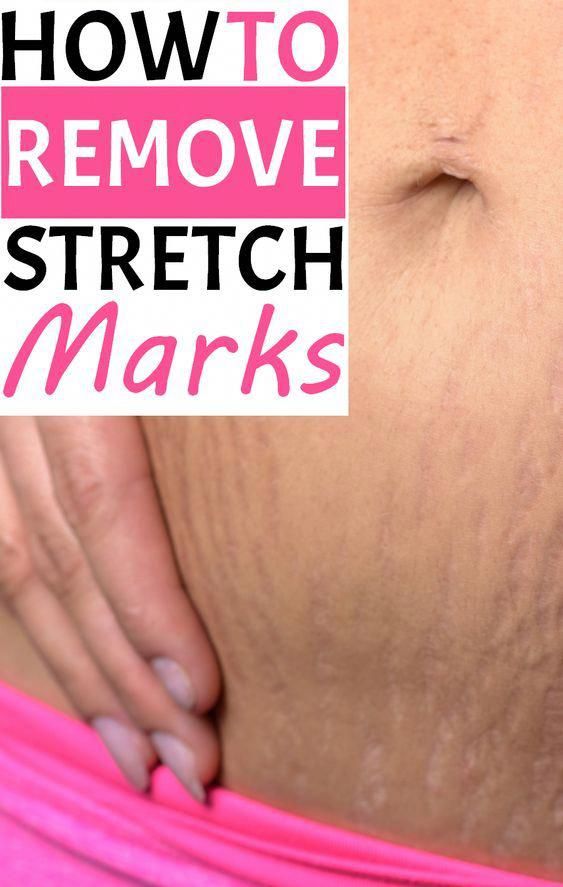 The right way to Tighten Stomach Skin Naturally # ...