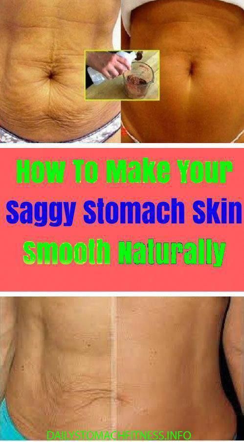 Ways to Make Your Saggy Stomach Skin Smooth Naturally # ...