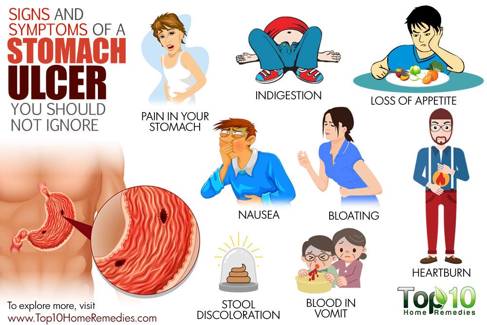 10 Signs and Symptoms of a Stomach Ulcer You Should Not ...