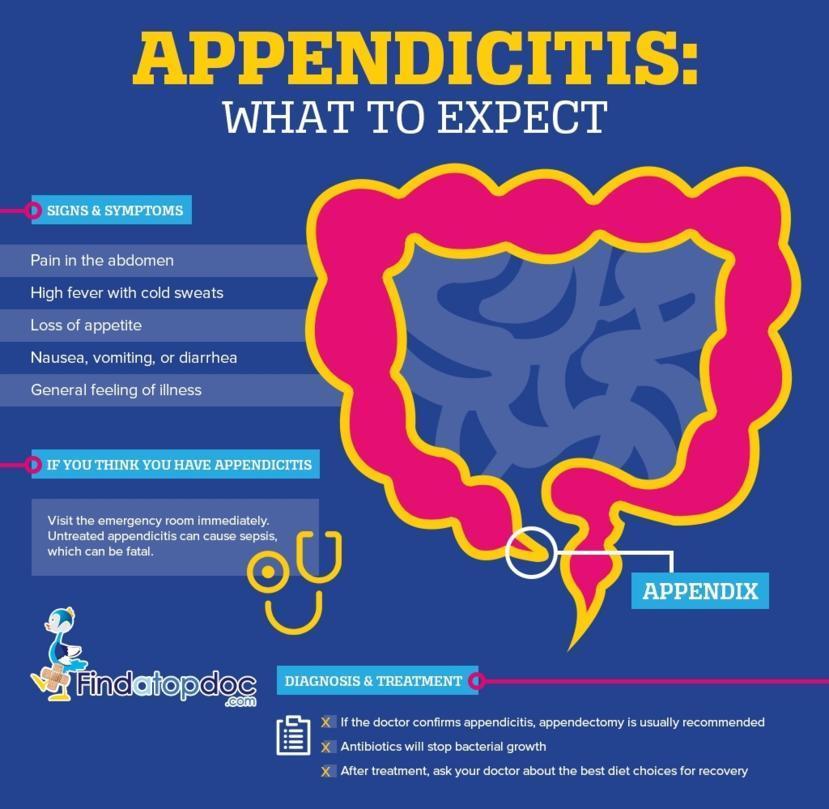 Appendicitis: Symptoms, Causes, Treatment, and Diagnosis ...