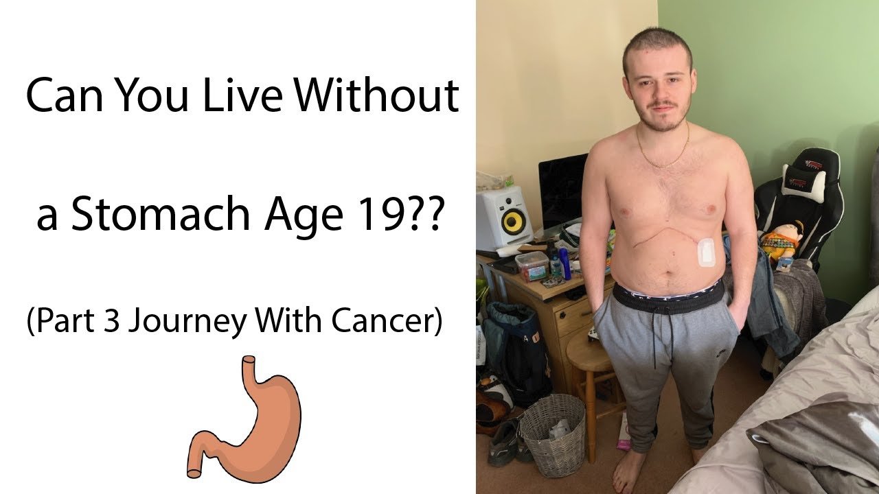 Can You Live Without a Stomach Age 19?? (Part 3 Journey ...