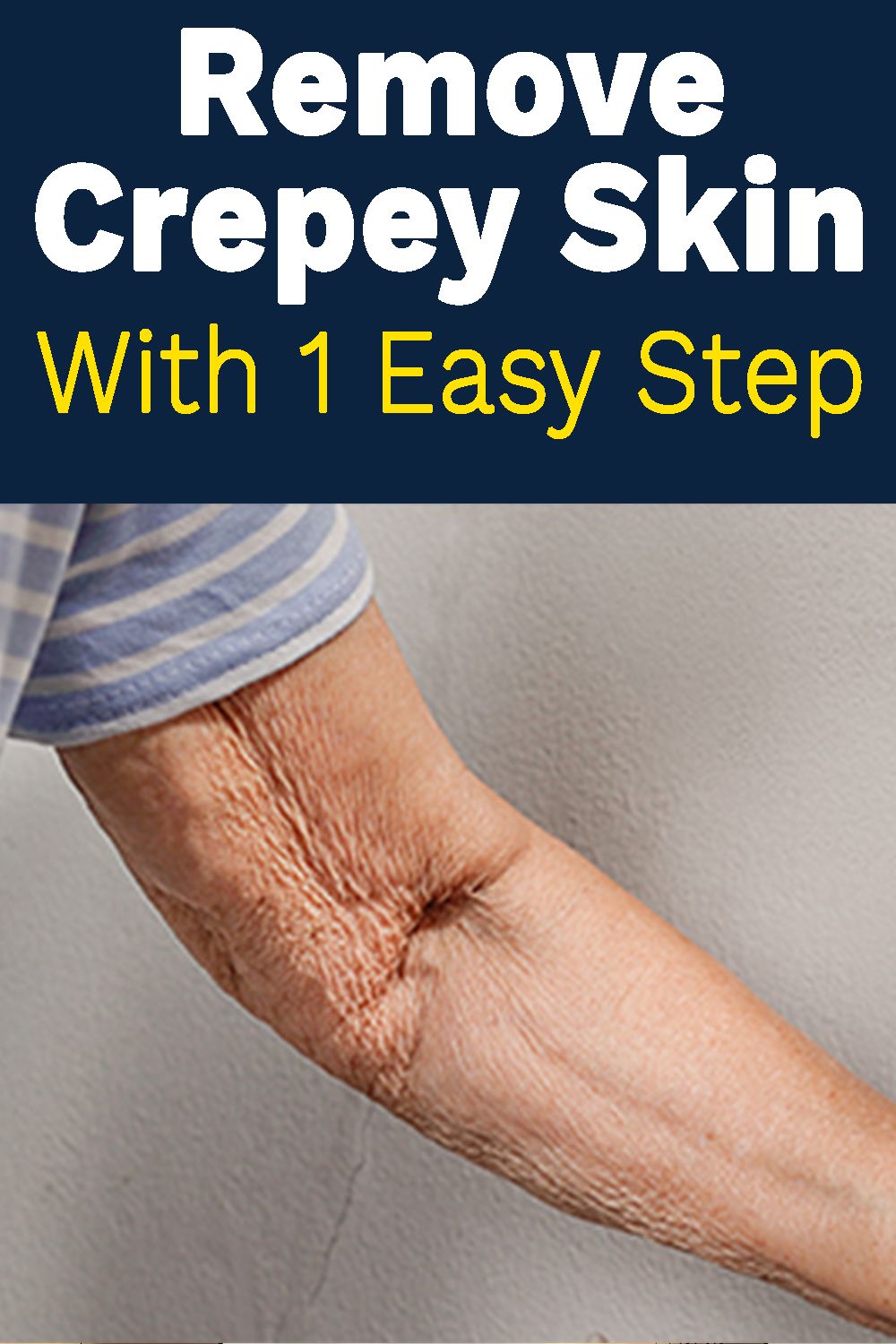 How To Get Rid Of Crepey Skin On Knees