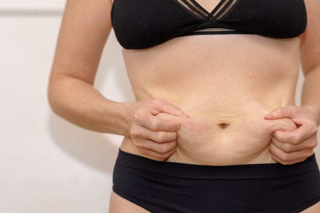 How to Lose Belly Fat After a Baby Quickly and Naturally ...
