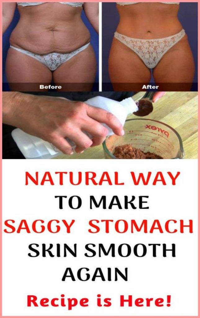 How To Make Your Saggy Stomach Skin Smooth Naturally # ...