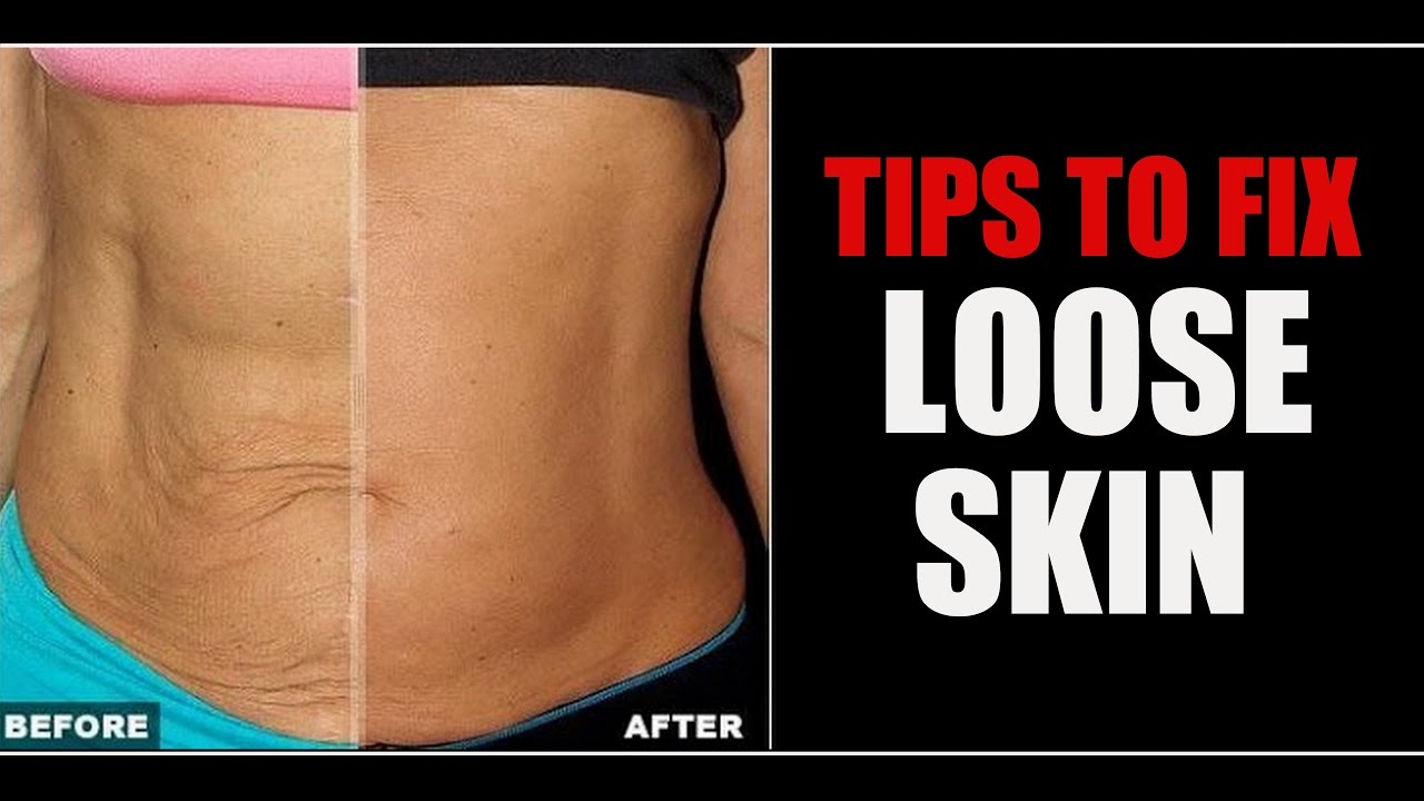 How to Tighten Up Loose Skin