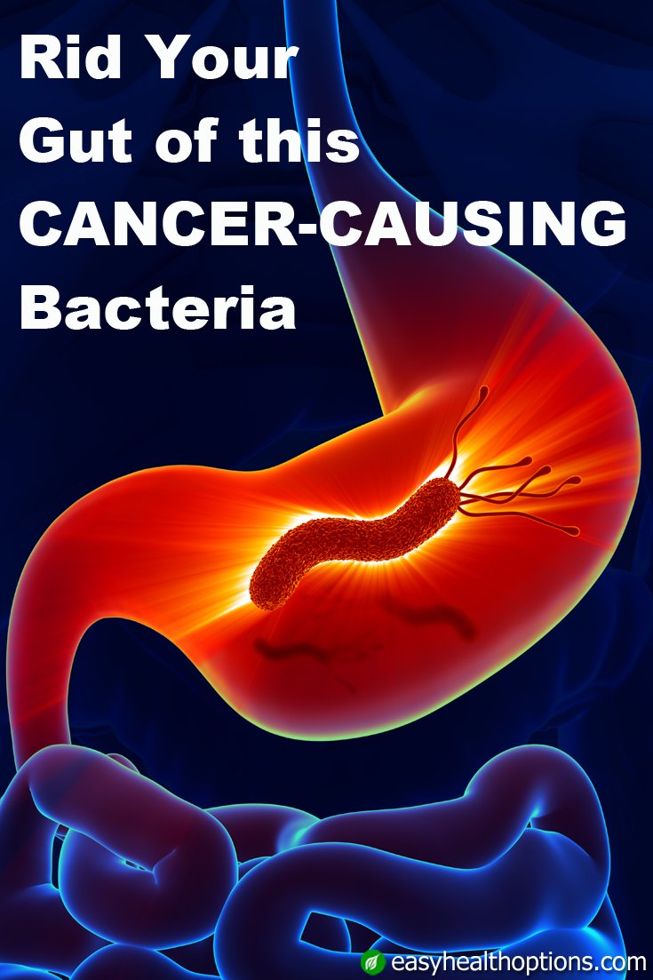 Rid your gut of this cancer