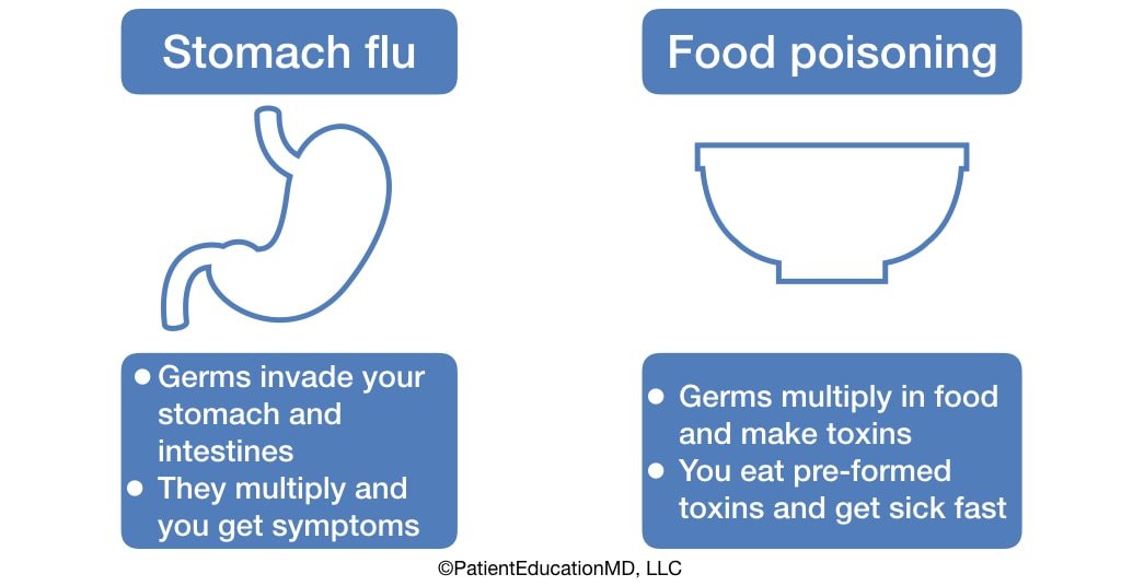 Stomach flu vs food poisoning