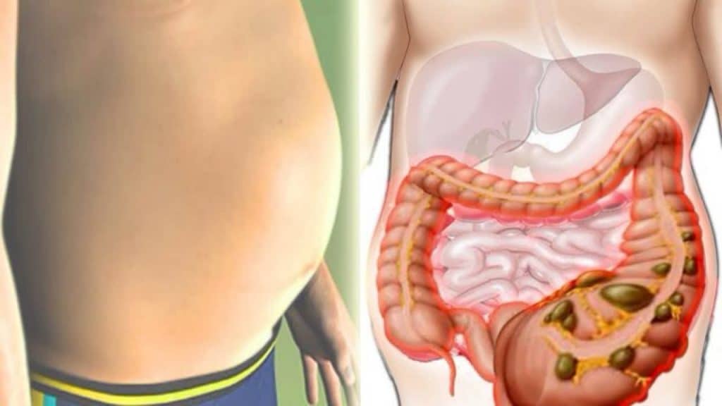 8 Causes Of Bloated Stomach And How To Treat Them ...