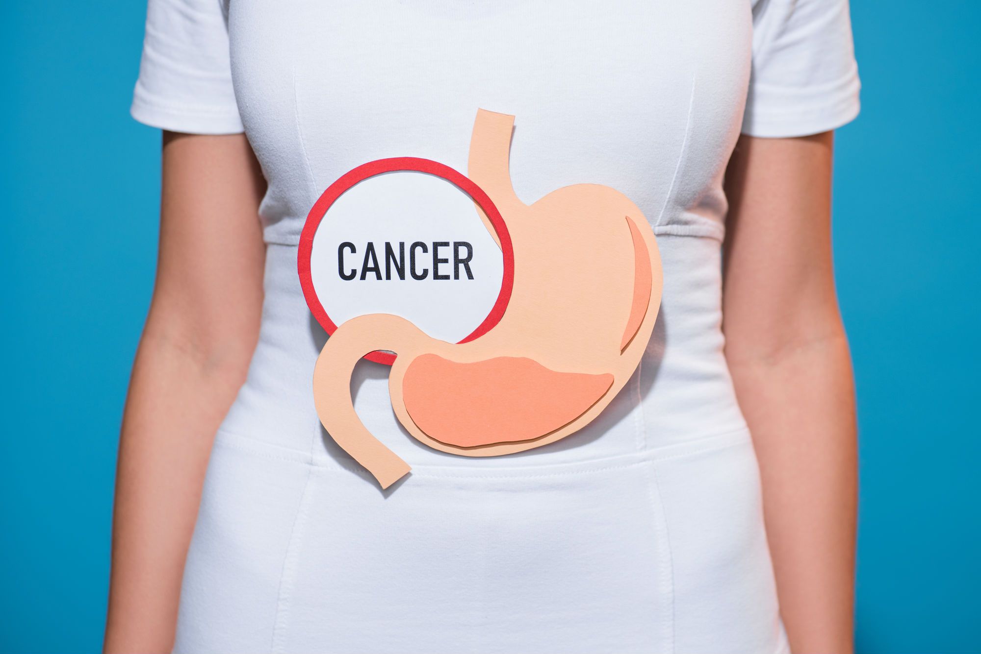 Can Nexium Cause Stomach Cancer?
