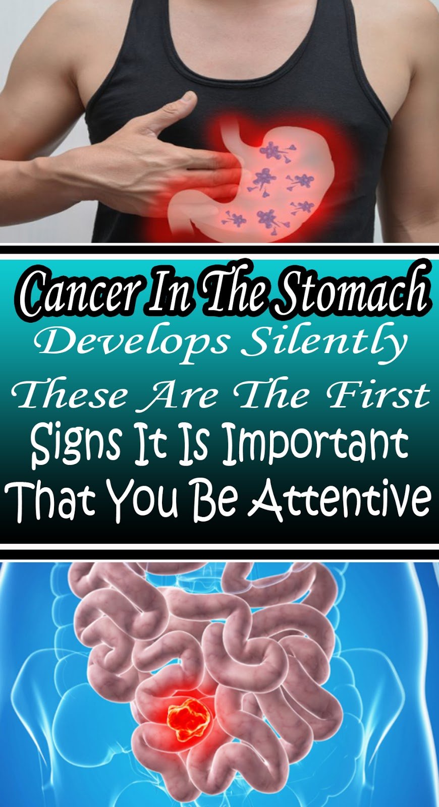 Cancer In The Stomach Develops Silently. These Are The ...