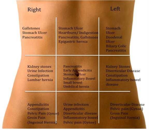 Stomach Ache Map  This Is What Your Stomach Ache Reveals ...