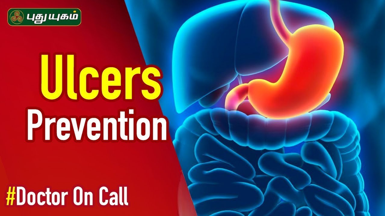 Stomach Ulcer Symptoms and Treatment