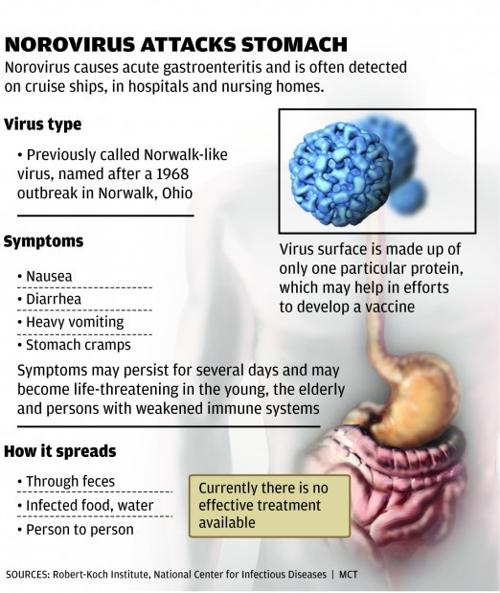 Stomach virus spreads around St. Louis