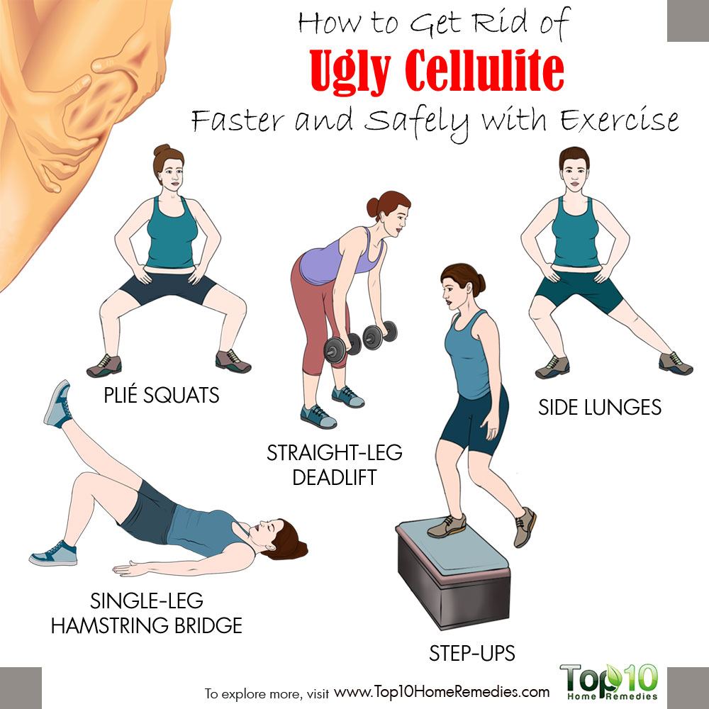 How to Get Rid of Cellulite Faster and Safely with ...