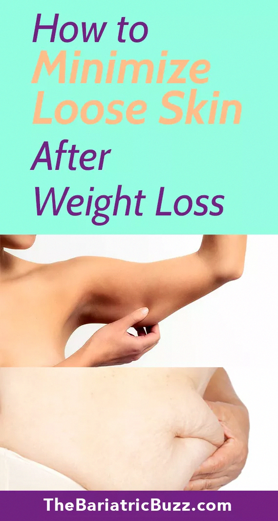 Pin on Lost Weight Saggy Stomach