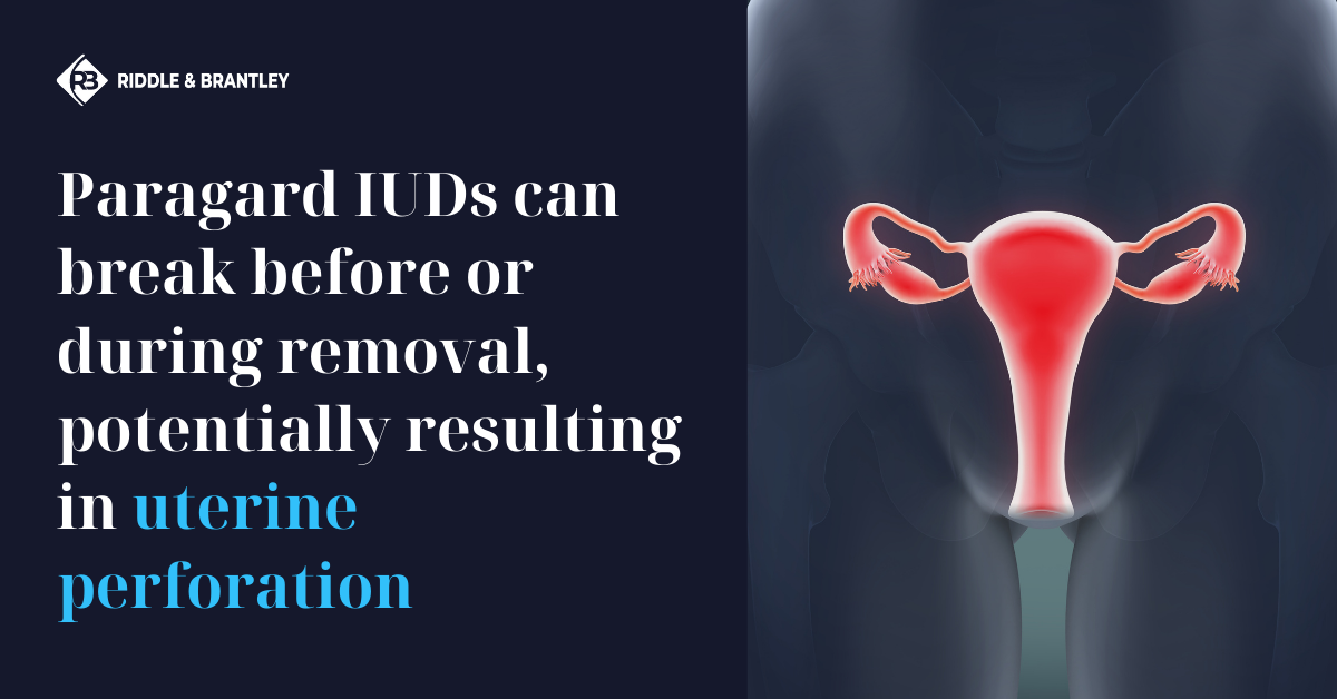 What Are Symptoms of Paragard IUD Perforation?
