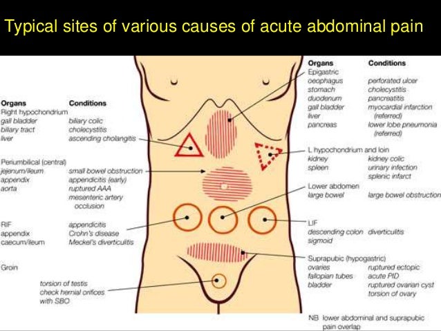 Causes Of Stomach Ache In Adults