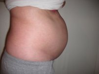 Extreme Bloating, What Causes Severe Belly Bloat And How ...