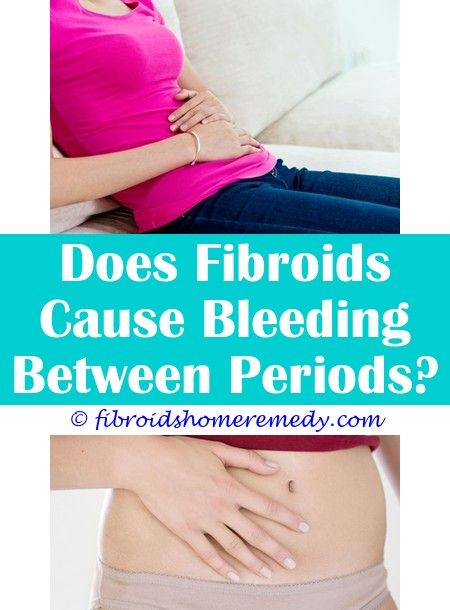 Pin on Fibroid Cyst On Ovary