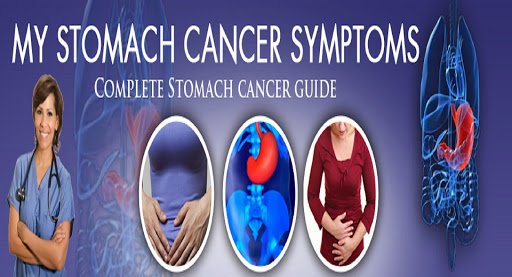 Stomach Cancer Omeprazole