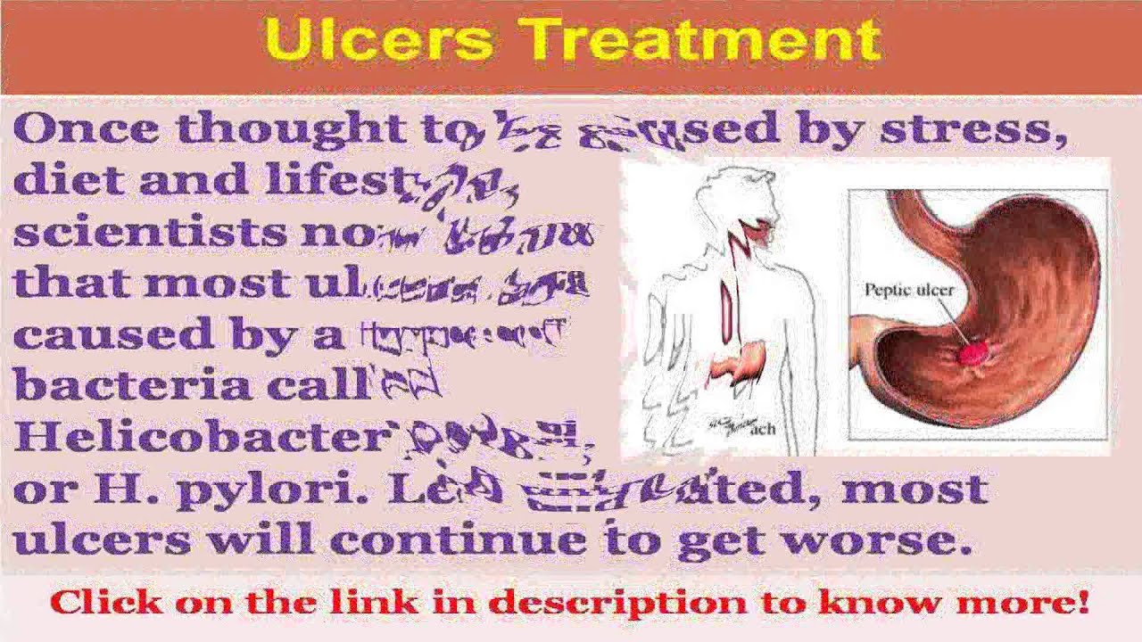 Ulcers bleeding ulcers in stomach symptoms