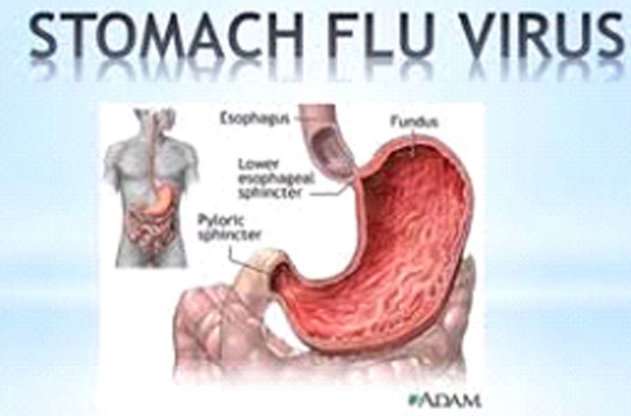 Viral Gastroenteritis (Stomach Flu)